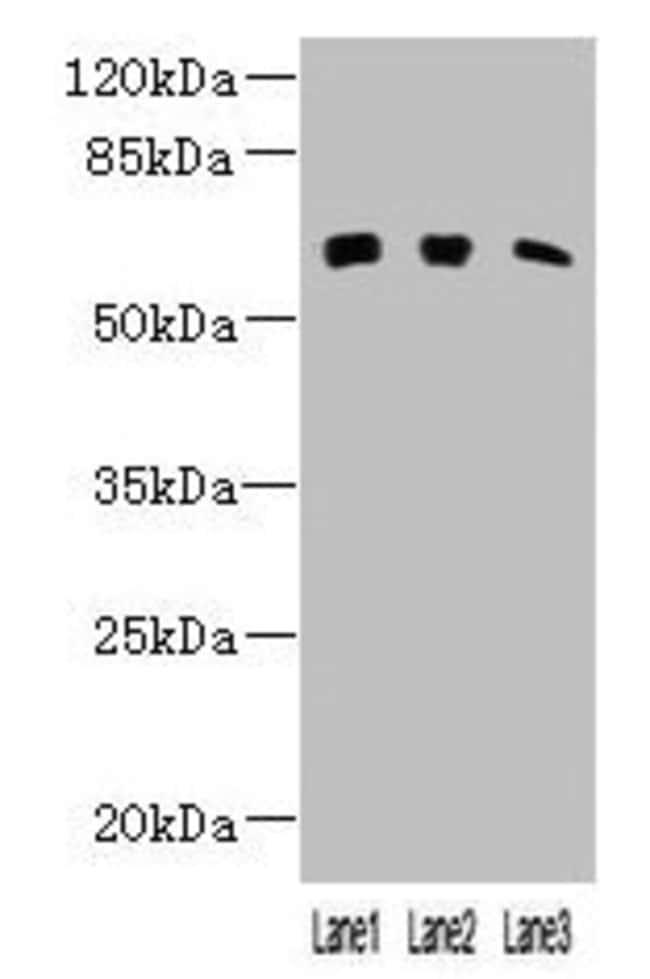 100UG KLHL23 ANTIBODY 100 ug
