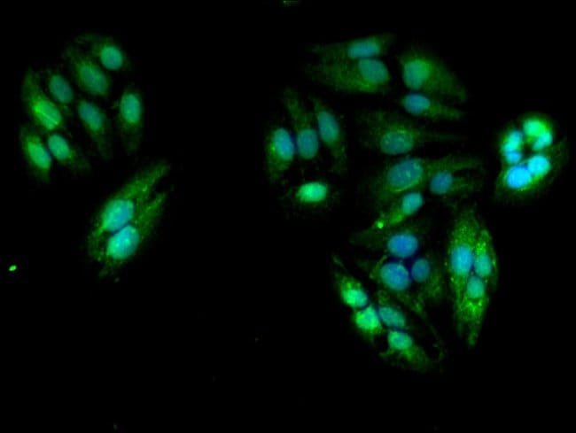 100UG TBC1D15 ANTIBODY 100 ug