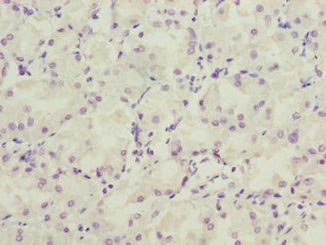 100UG LRRC20 ANTIBODY 100 ug