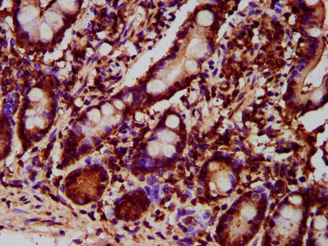 100UG GPT2 ANTIBODY 100 ug