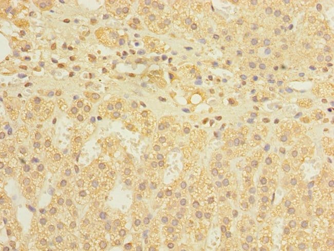 100UG DIS3L ANTIBODY 100 ug