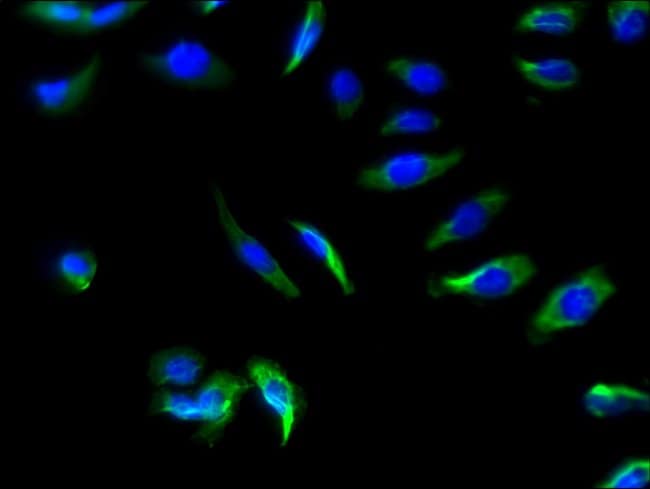 100UG SLC22A17 ANTIBODY 100 ug