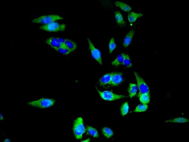 100UG SLC20A1 ANTIBODY 100 ug