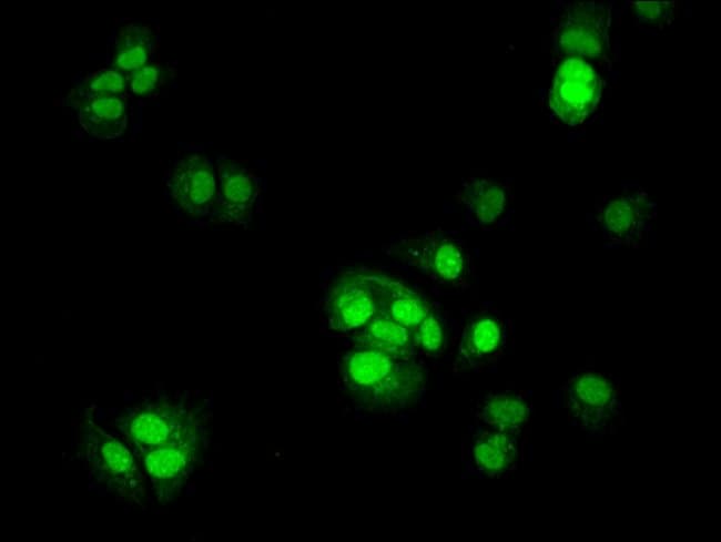 100UG TSR2 ANTIBODY 100 ug