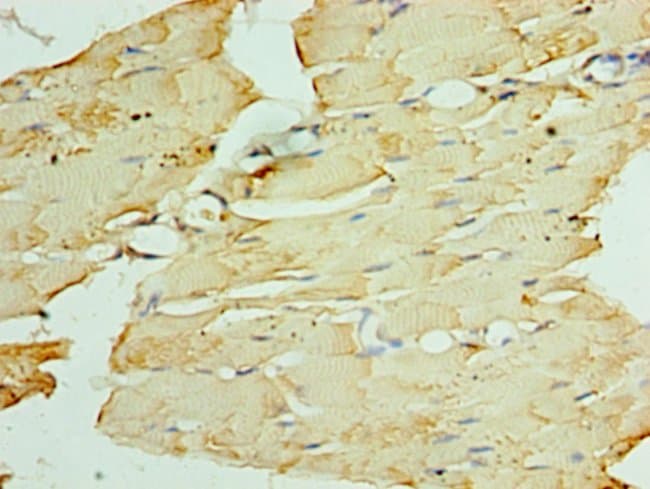 100UL ATGL ANTIBODY 100 ul