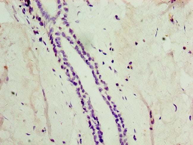 100UL ATG4C ANTIBODY 100 ul