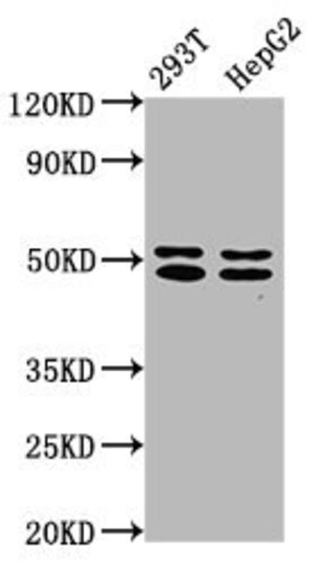 100UG TRNT1 ANTIBODY 100 ug
