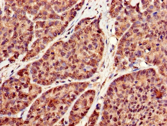100UG RBFA ANTIBODY 100 ug