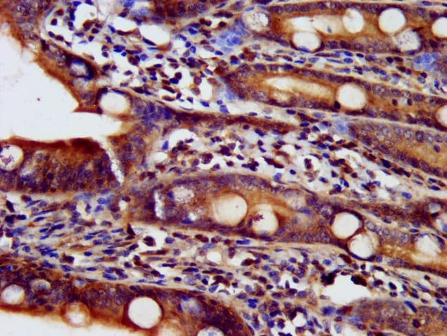 100UG NDUFAF2 ANTIBODY 100 ug