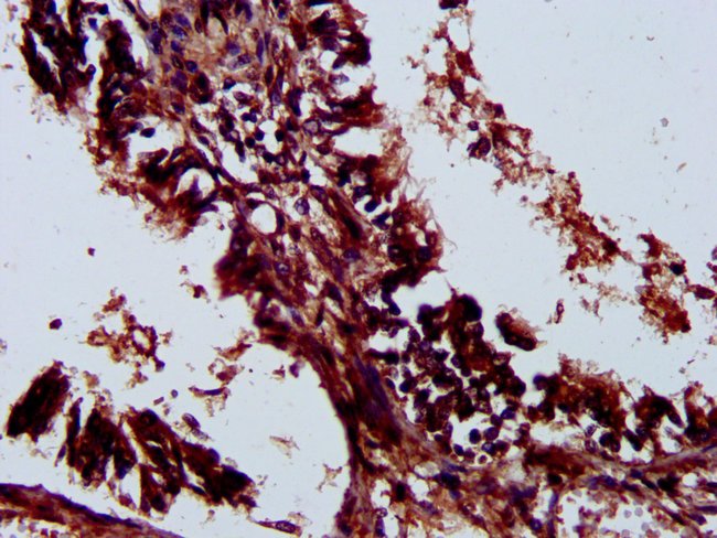 100UG LILRA3 ANTIBODY 100 ug