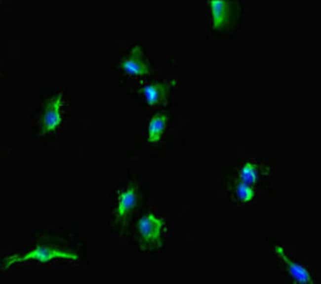 100UG SLC38A9 ANTIBODY 100 ug