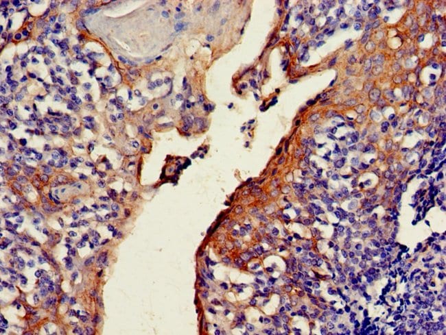 100UG C4ORF14 ANTIBODY 100 ug