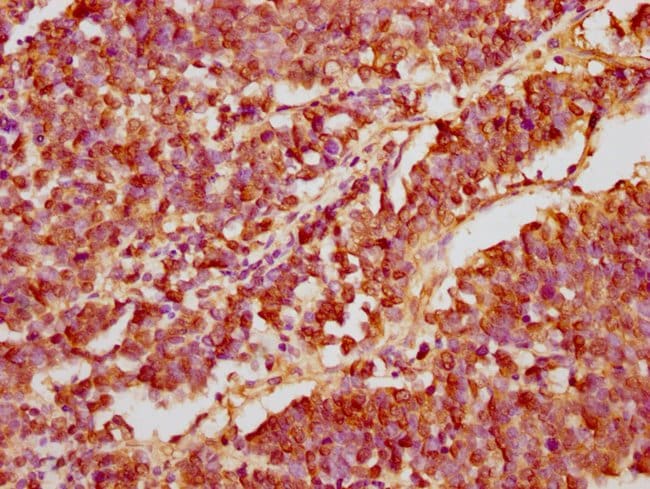 100UL GANC ANTIBODY 100 ul