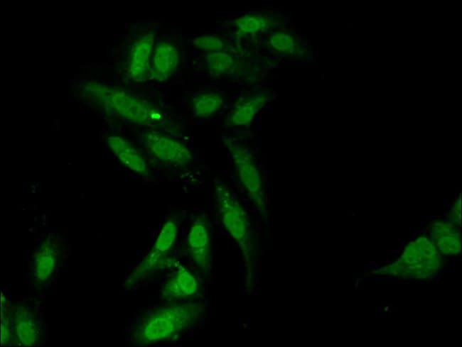 100UG L3MBTL2 ANTIBODY 100 ug