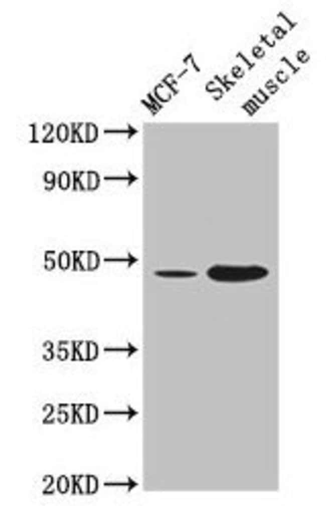 100UG ARRDC3 ANTIBODY 100 ug