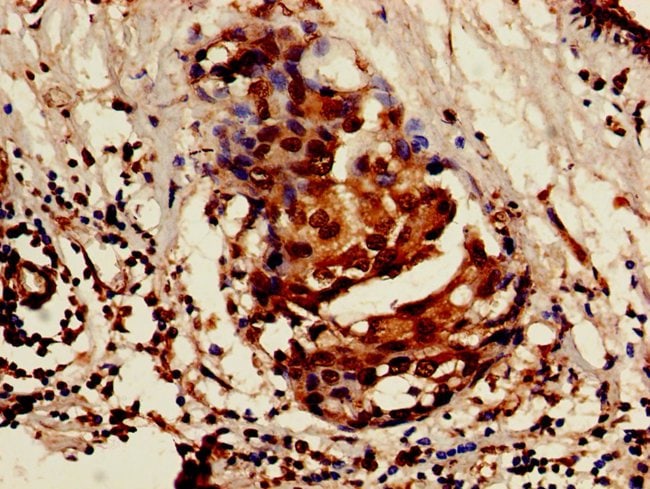 100UG ISOC1 ANTIBODY 100 ug