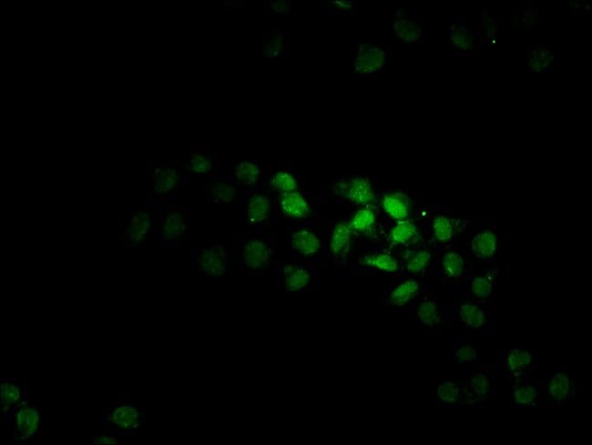 100UG KTI12 ANTIBODY 100 ug