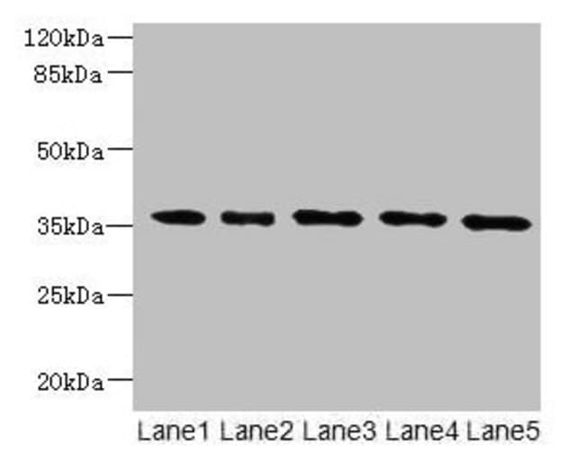 100UG OXNAD1 ANTIBODY 100 ug