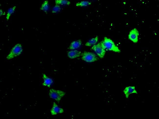 100UL ITCH ANTIBODY 100 ul