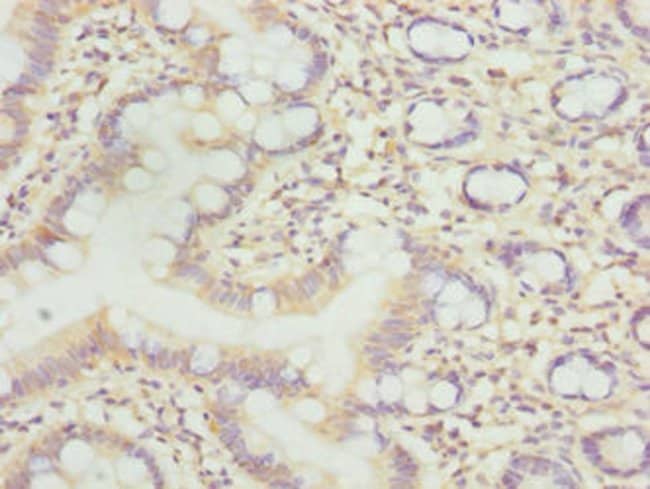 100UG LLCFC1 ANTIBODY 100 ug