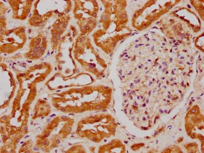 100UG FIZ1 ANTIBODY 100 ug