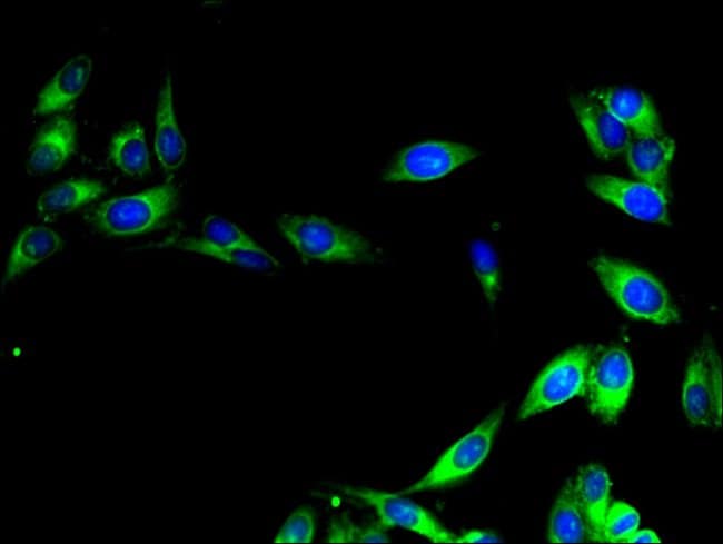 100UG CISD2 ANTIBODY 100 ug
