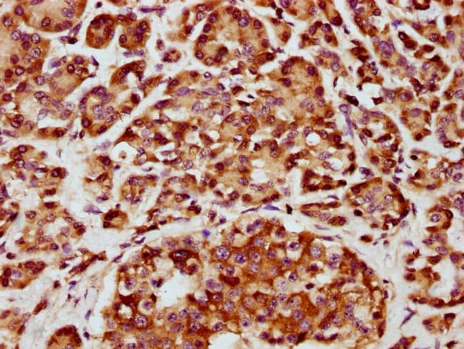 100UG CHST14 ANTIBODY 100 ug
