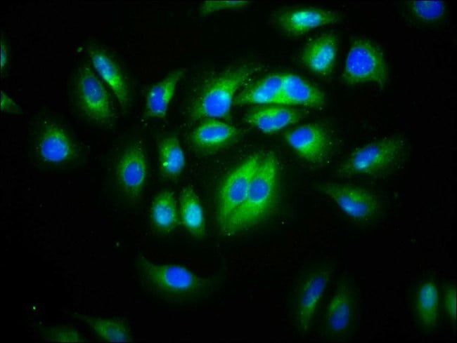 100UG CD99L2 ANTIBODY 100 ug