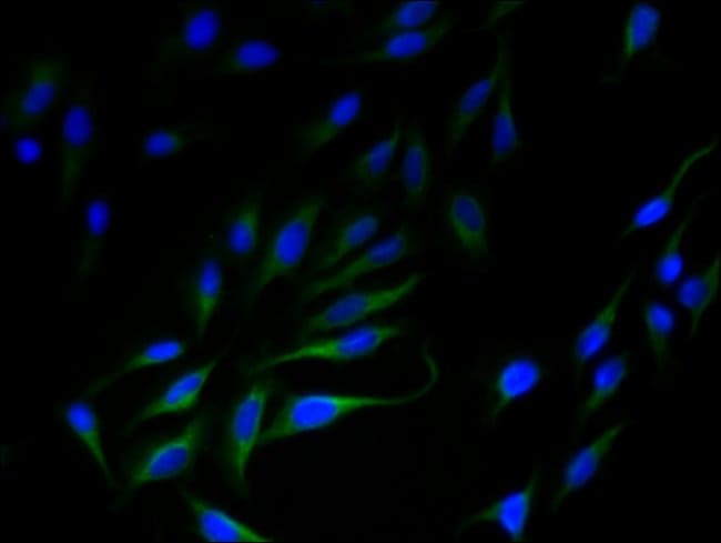 100UG SLC35F5 ANTIBODY 100 ug