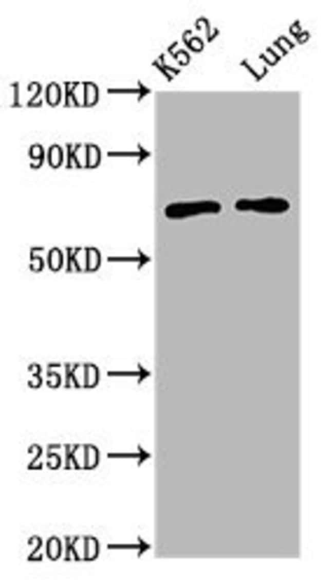 100UG POF1B ANTIBODY 100 ug