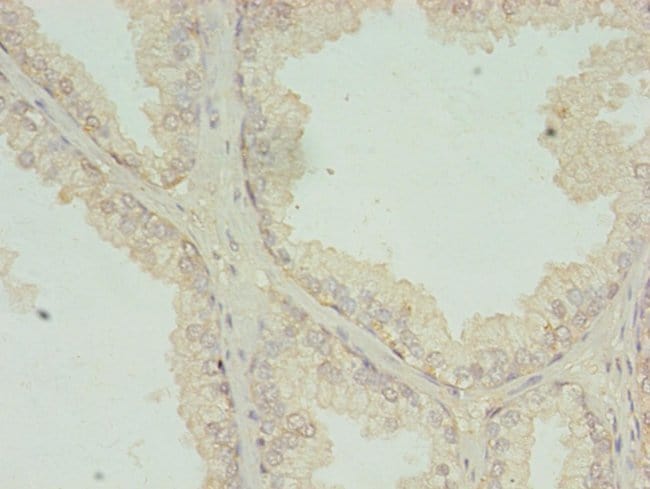 100UG RQCD1 ANTIBODY 100 ug