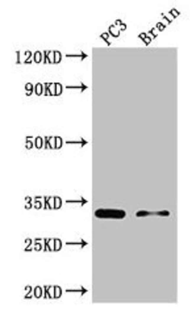 100UG HOXB13 ANTIBODY 100 ug