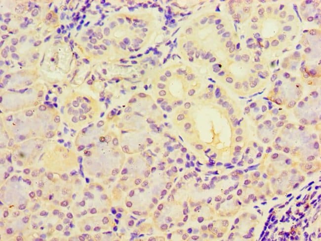 100UL C19ORF10 ANTIBODY 100 ul