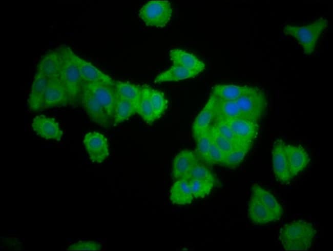 100UG ELMOD3 ANTIBODY 100 ug