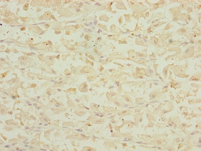 100UL DHTKD1 ANTIBODY 100 ul