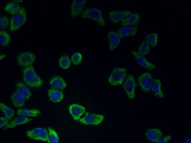 100UG CATSPER2 ANTIBODY 100 ug