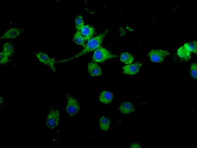 100UG PCQAP ANTIBODY 100 ug