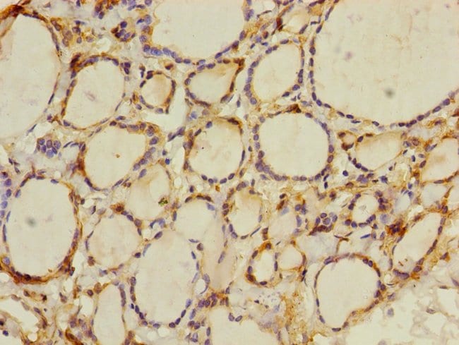 100UL CRBN ANTIBODY 100 ul