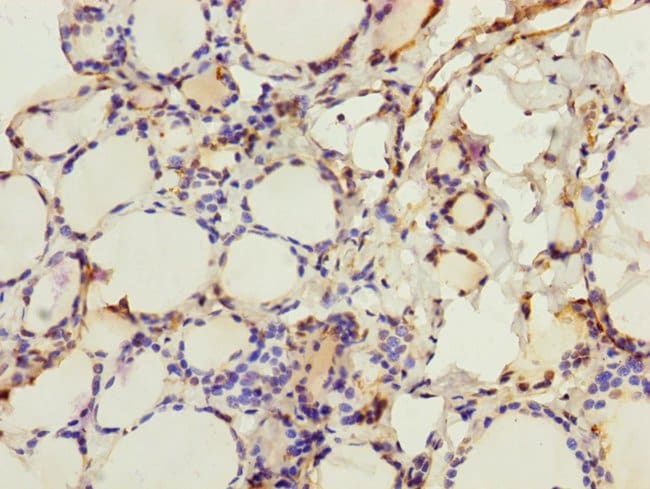 100UL CRBN ANTIBODY 100 ul