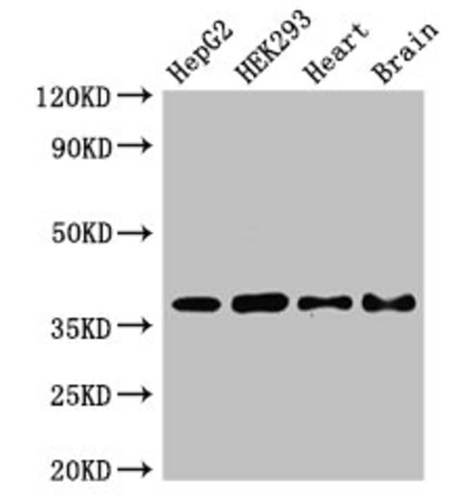 100UG PNKD ANTIBODY 100 ug