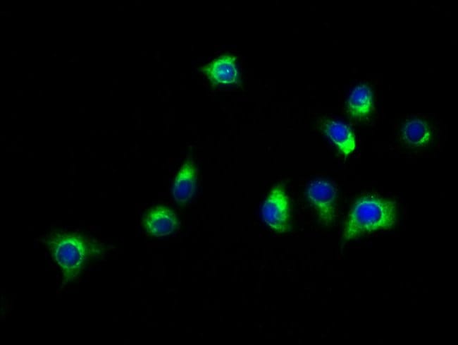 100UG SLC16A11 ANTIBODY 100 ug