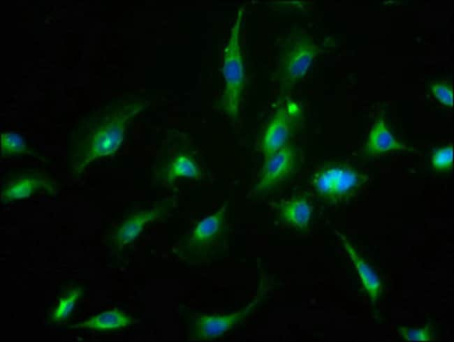 100UG CNNM3 ANTIBODY 100 ug
