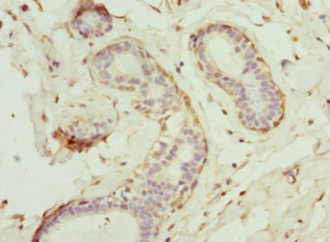 100UL GCNT2 ANTIBODY 100 ul