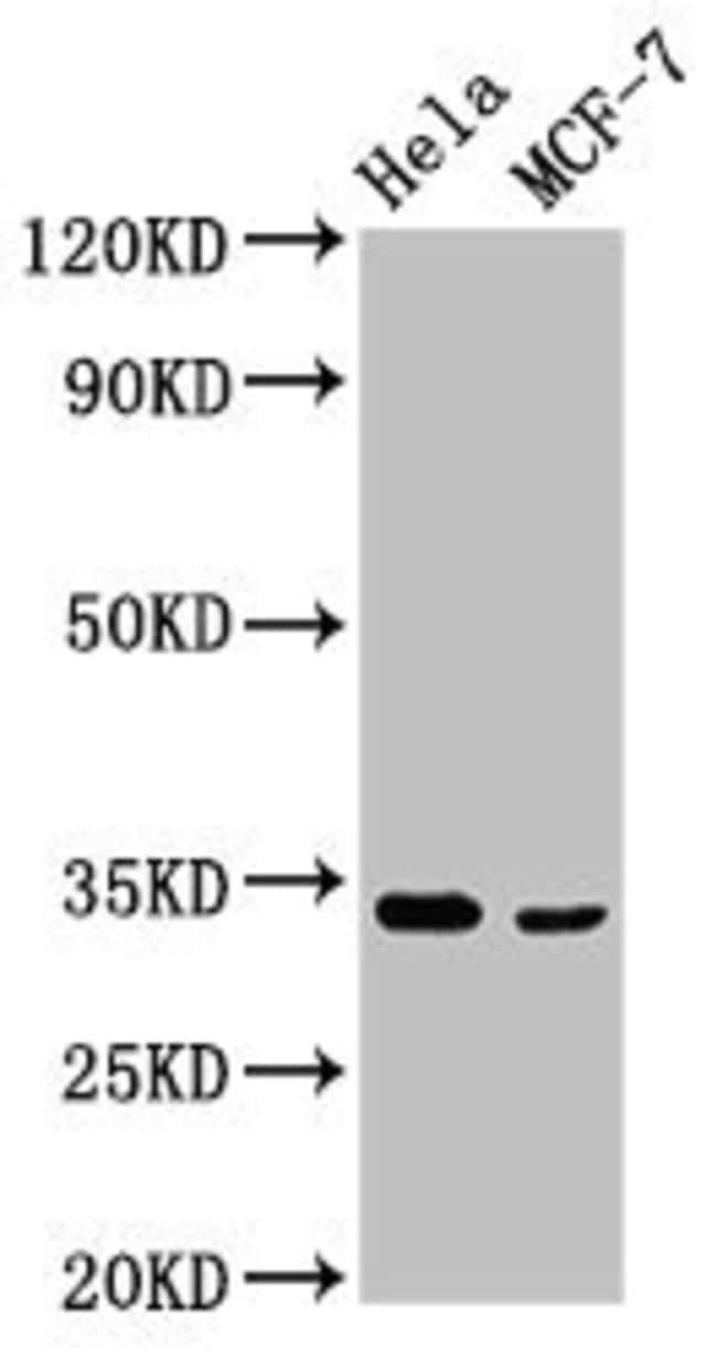 100UG NFKBID ANTIBODY 100 ug