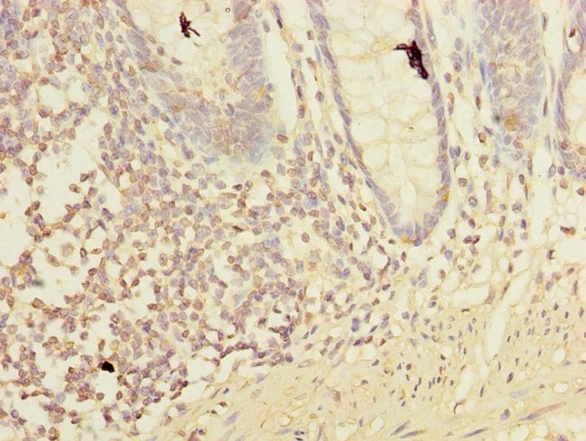 100UG LMO3 ANTIBODY 100 ug