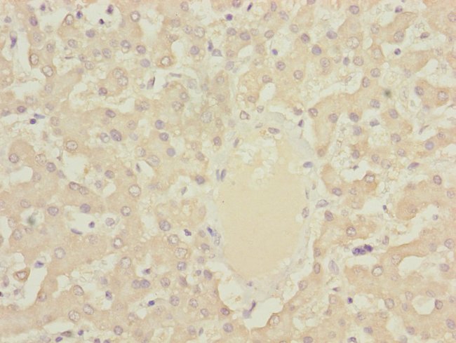 100UL DYNC2LI1 ANTIBODY 100 ul