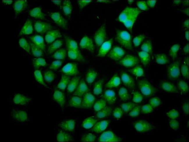 100UG BICD2 ANTIBODY 100 ug