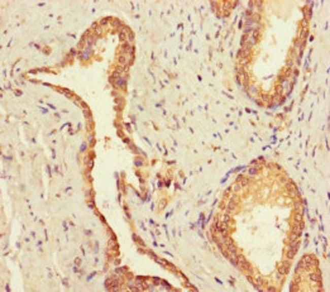 100UG UBE2Q2 ANTIBODY 100 ug