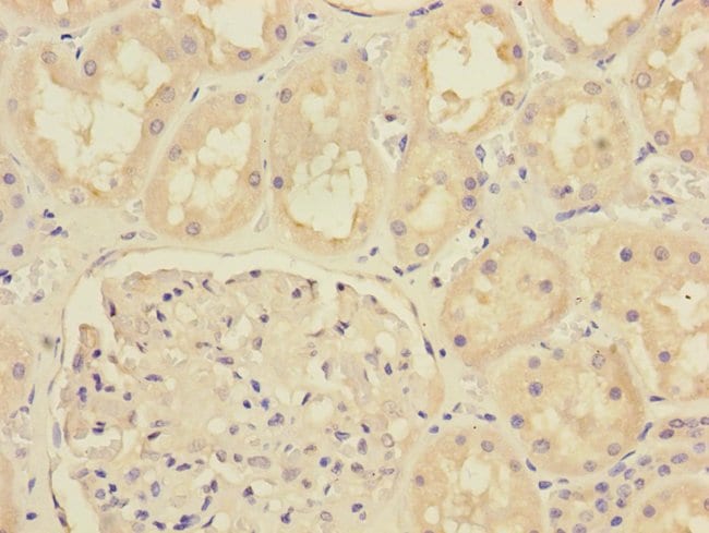 100UL MTO1 ANTIBODY 100 ul