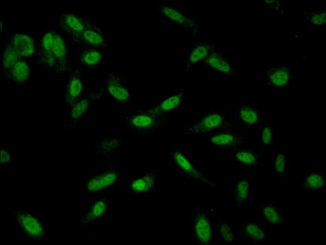 100UG SMARCD1 ANTIBODY 100 ug